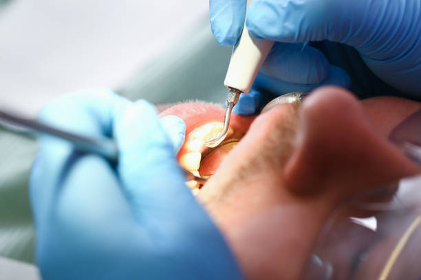 Best Same-Day Emergency Dental Services in Glenwood, IL