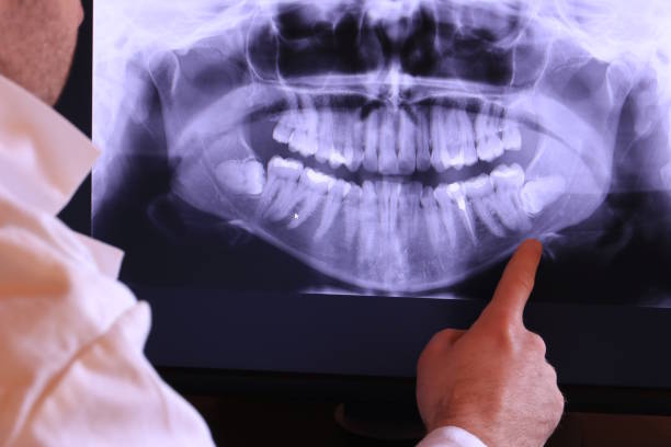 Best Emergency Tooth Extraction in Glenwood, IL