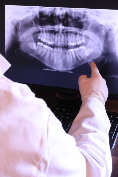 Best Emergency Gum Treatment in Glenwood, IL